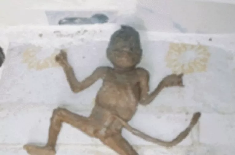 O femeie din Statele Unite a dat nastere unui monstru